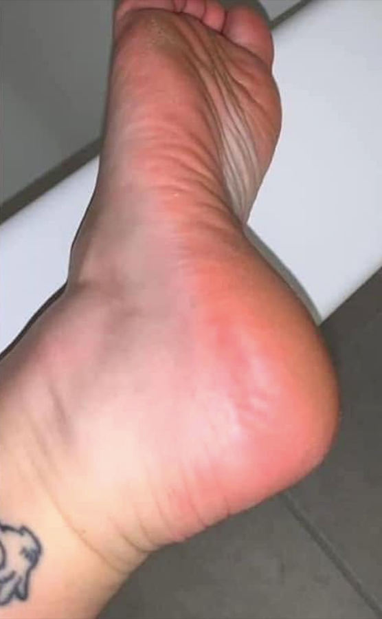 APRÈS